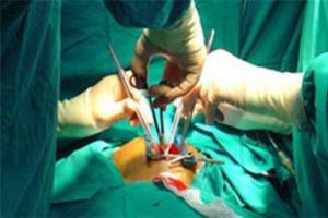 'By-pass mı, stent mi?' tartışmasına son