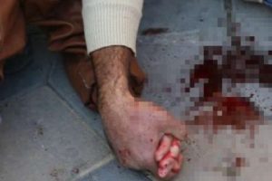 Ambulansı el ele beklediler