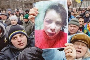 Gazeteciye dayak olayına, ilk sayfa karartması