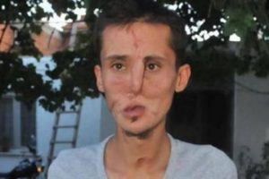 İlk soru: Y&uuml;z&uuml;m nasıl oldu