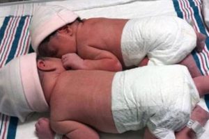 İkizler ama aynı yıl d&uuml;nyaya gelmediler