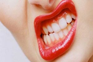 Stres dişlerinizi aşındırmasın
