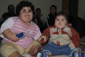 Obez kardeşler tedavinin ardından tığ gibi oldular