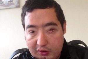 20 ay sonra g&ouml;z bantlarından kurtuldu