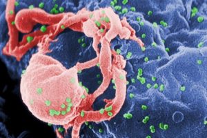 1.6 milyon kişi AIDS'ten &ouml;ld&uuml;'