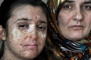 İlkokulu evde bitirdi