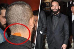 Ensesindeki bandın sırrı ne?