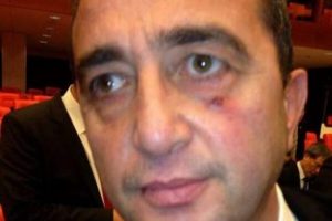 CHP'li vekil hastanelik oldu