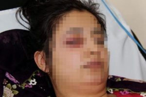 Eşi ve ailesi tarafından hastanelik edildi