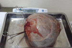 Tıp tarihine ge&ccedil;ecek olay!