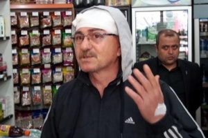 Sigaranı s&ouml;nd&uuml;r dedi başına gelmeyen kalmadı