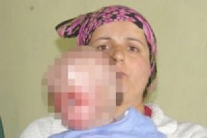 Y&uuml;z nakli olursa d&uuml;nya onu konuşacak