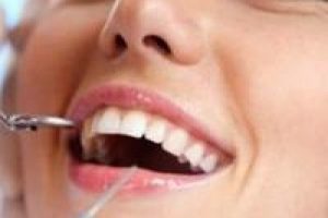 Ortodontik tedavide görünmeyen tel dönemi