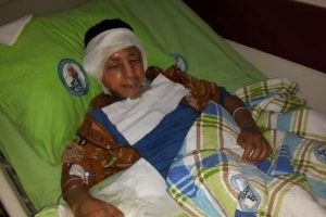 Sobaya oda spreyi sıkan &ccedil;ocuk yandı