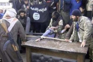 Hırsızın elini kesip fotoğraflarını Twitter'dan yayınladılar