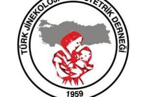 TJOD: K&uuml;rtaj gizlice kaldırıldı