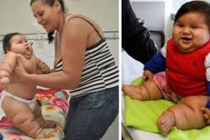 Kolombiyalı 8 aylık bebek 20 kiloya ulaştı