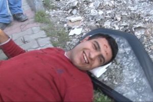 Yaralıların kanal merakı şaşırttı