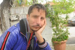 Y&uuml;z nakli bitti sıra evlilikte