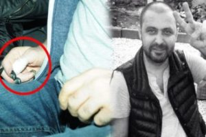 İşler'in parmaklarındaki morluk dikkat &ccedil;ekti