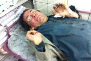 Haber yapmaya gitti kendisi haber oldu