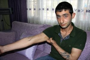 Uyuşturucu bağımlısı gen&ccedil; Başbakan'a seslendi