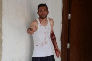 Uyuşturucu bağımlısı gen&ccedil; yardım istiyor