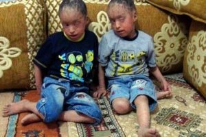 G&ouml;zleri dikilmişti şimdi o g&uuml;n&uuml; bekliyorlar