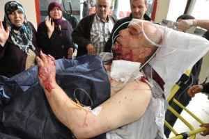 Komşu dehşet sa&ccedil;tı!