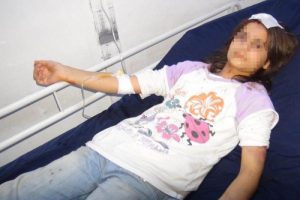 11 yaşındaki &ccedil;ocuğa &uuml;vey anne şiddeti