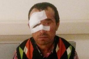 2 &ccedil;obana kurt saldırdı