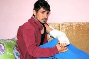 İnanılmaz olay! Şehrin g&ouml;beğinde kolunu kestiler!