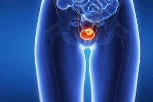 FDA bu ilaca '&ccedil;ığır a&ccedil;ıcı tedavi' dedi