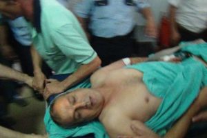 Ameliyatlık hastanın asans&ouml;r &ccedil;ilesi