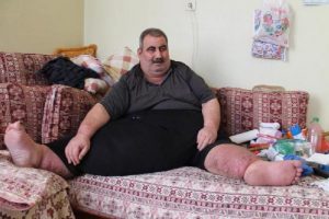 Fil hastası 4 ayda 28 kilo verdi