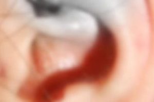 LYS'de skandal! Piercing'i penseyle s&ouml;kt&uuml;ler...