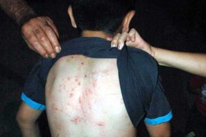 Mahalleyi pireler bastı, insanlar uyuyamıyor