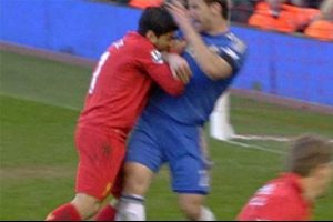 2 bin lira... Dişine sağlık Suarez!