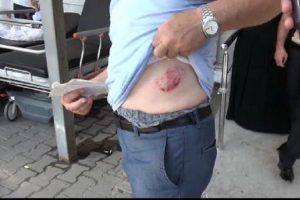 Tasmasız k&ouml;peğin saldırısına uğradı