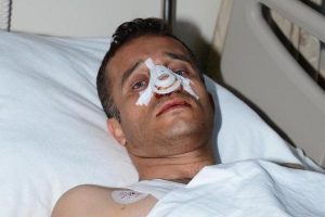 Hasta yakını g&uuml;venlik g&ouml;revlisinin burnunu kırdı