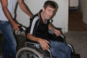 Sigara y&uuml;z&uuml;nden bacakları kesildi elleri ise...