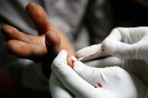 BM, AIDS raporunu a&ccedil;ıkladı...