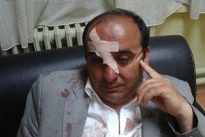 AK Partili başkana meydan dayağı!