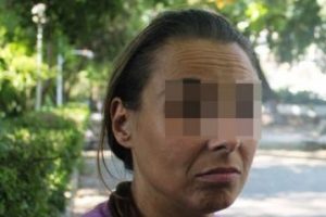 AİDS olan o kıza yardım yağıyor