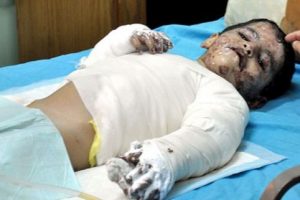 Gazzeli 4 yaşındaki Yamen'in y&uuml;rek burkan &ouml;yk&uuml;s&uuml;