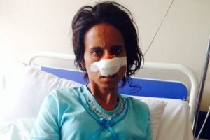 Vahşet! Eşini dağa ka&ccedil;ırıp burnunu kesti!