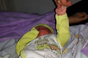 Doğum sırasında kolu &ccedil;ıktı