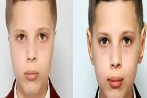 Kaburgalarından kulak yapıldı