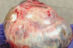 60 kiloluk dev t&uuml;m&ouml;r g&ouml;renleri şaşırttı!