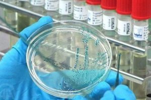 Osmaniye'de ebola ş&uuml;phesi
